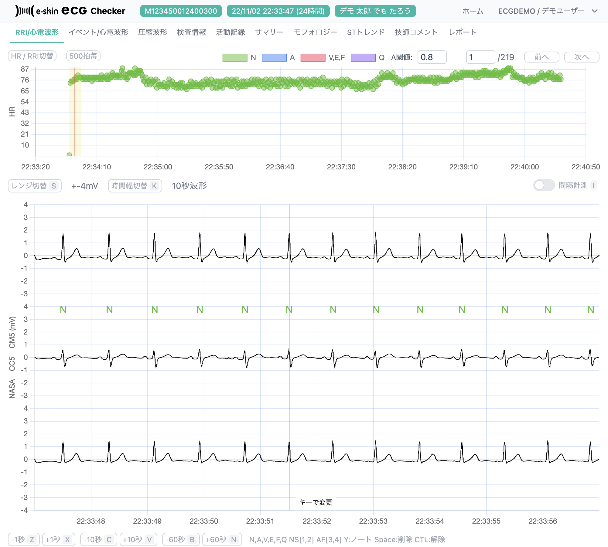 # 心電データビューアー/ECG Checker