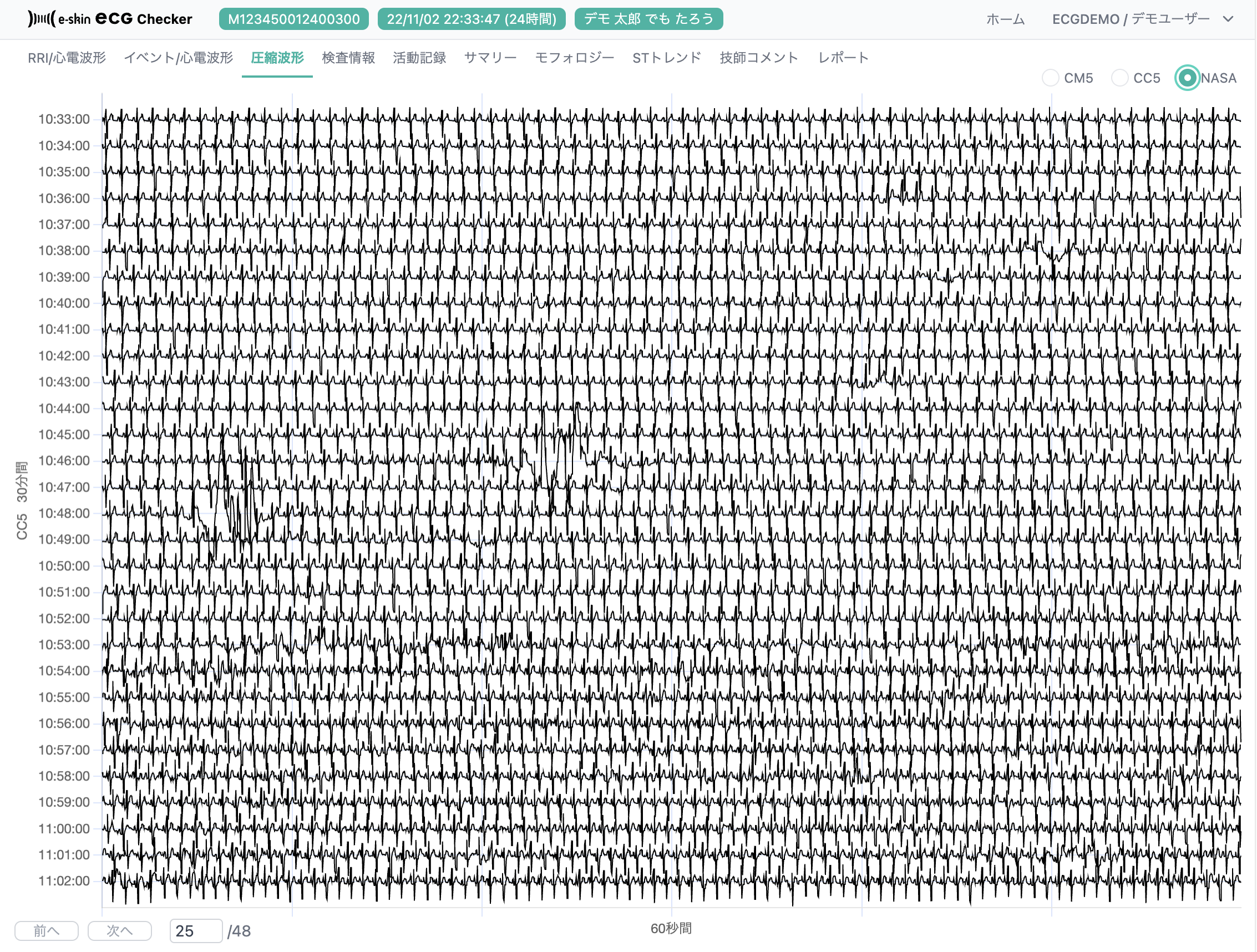 # 心電データビューアー/ECG Checker