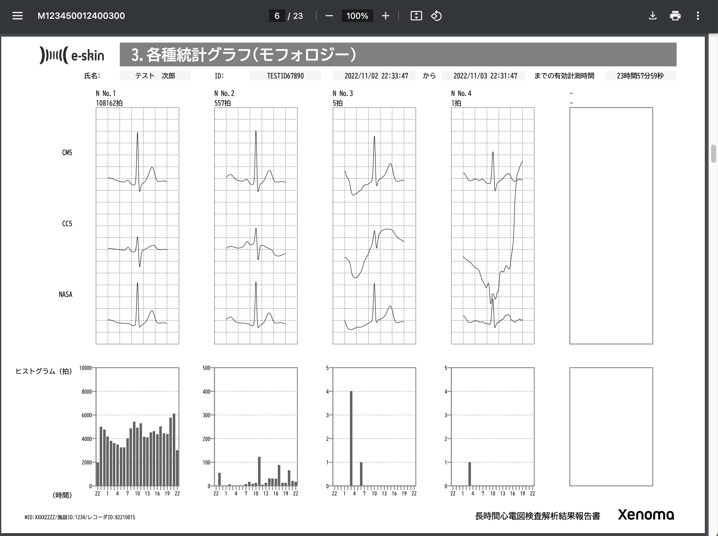 e-skin_ECGホルター心電図検査_レポート_サンプル