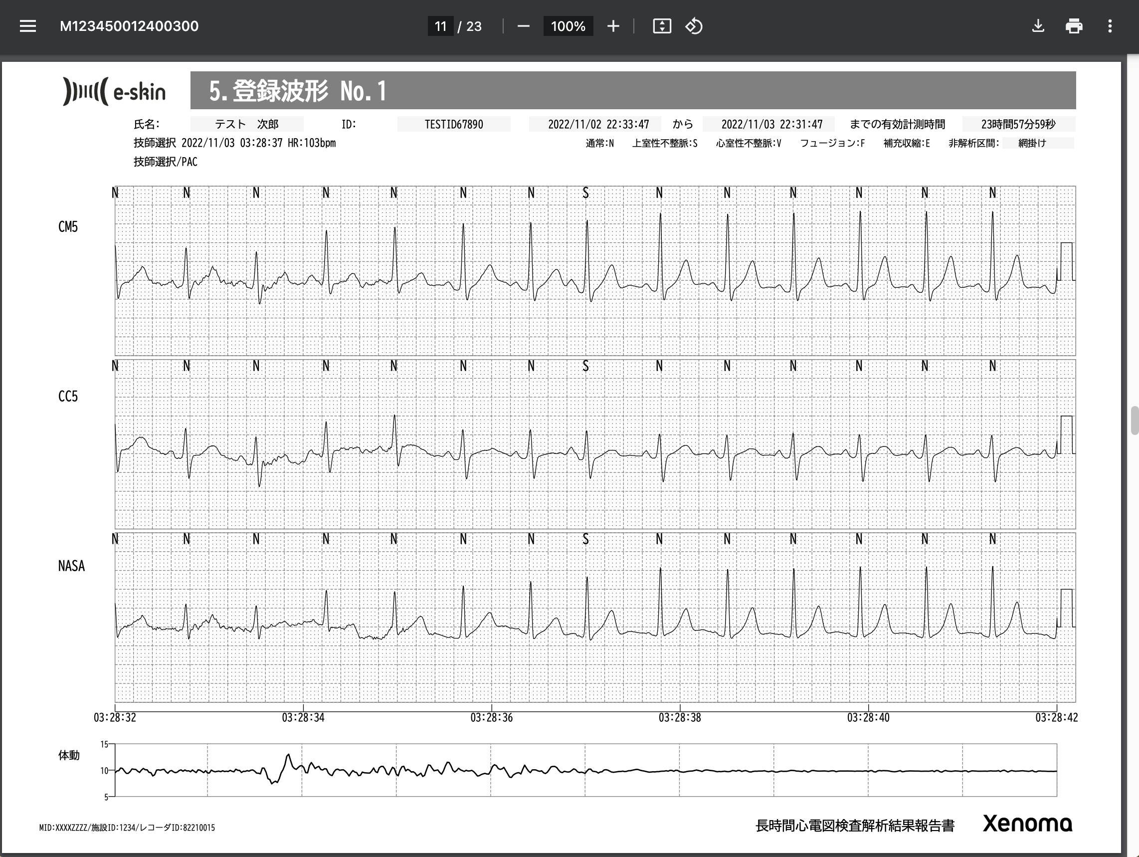 e-skin_ECGホルター心電図検査_レポート_サンプル